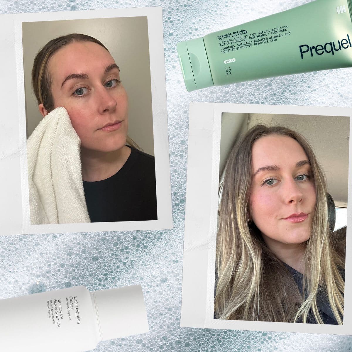  I Tested 22 Face Washes for Rosacea—These 8 Derm-Approved Options Came Out on Top 