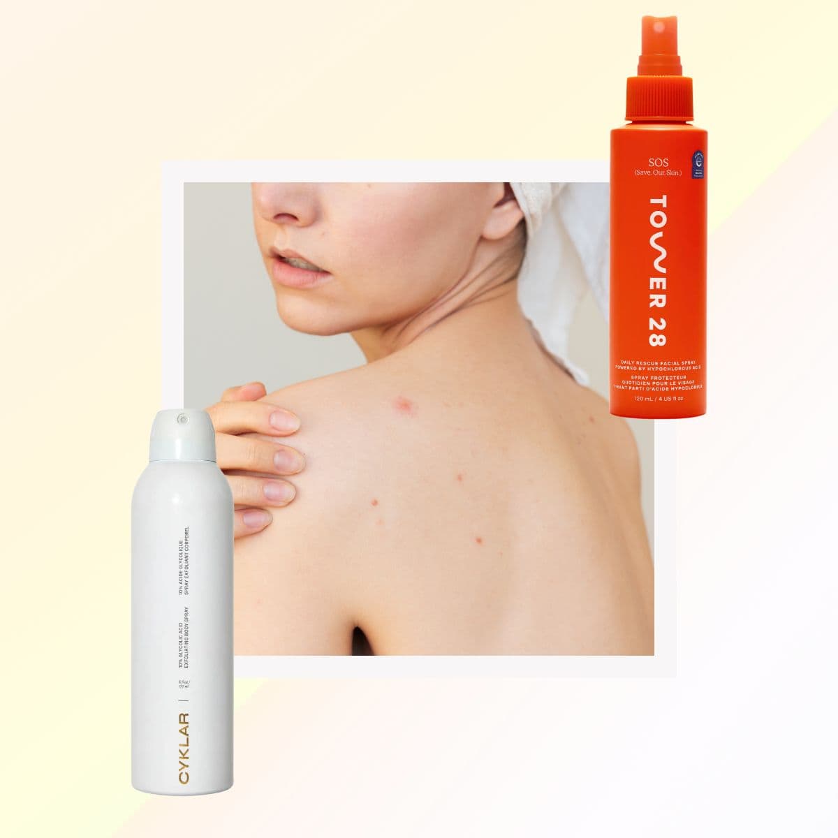 I Found the 10 Best Body Acne Products for the Chest, Back, Butt, and Wherever Else You’re Breaking Out